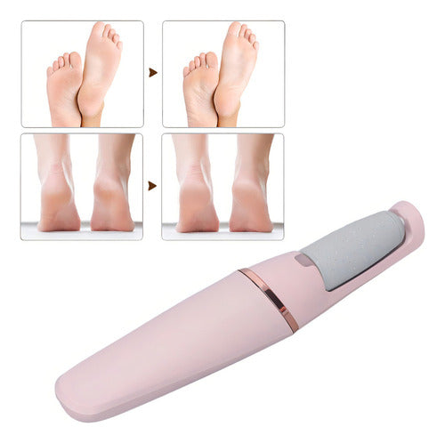 Removedor Eléctrico de Callos